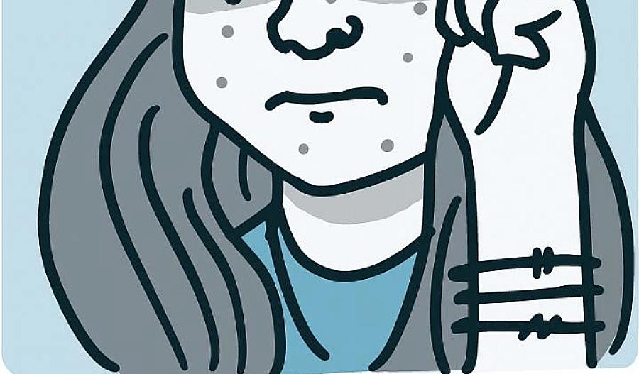 Ilustración de una joven con acne