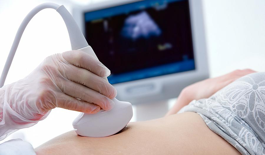Una fotografía muestra a una mujer recibiendo un examen de ultrasonido en su abdomen.